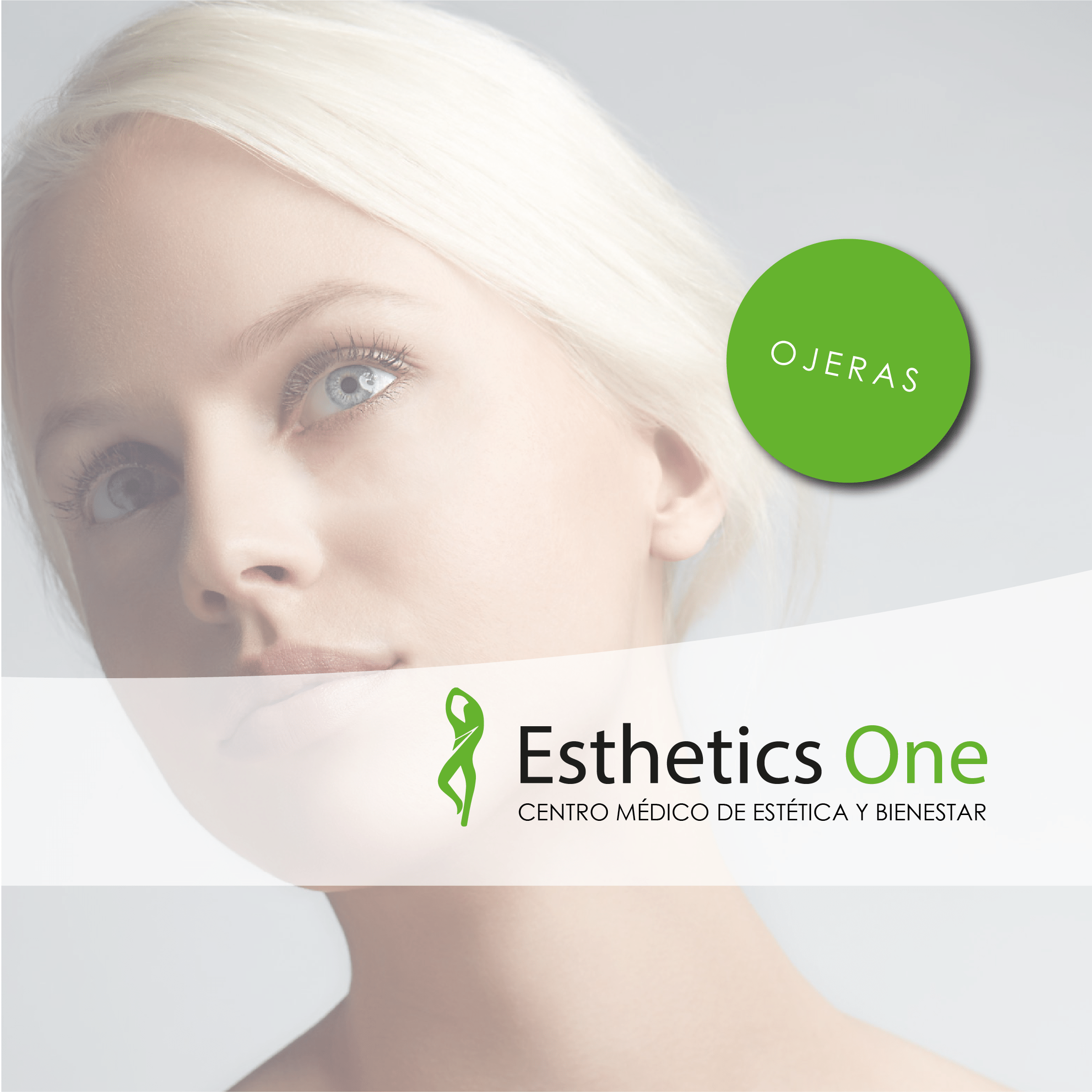 Relleno de Ojeras con Acido Hialuronico